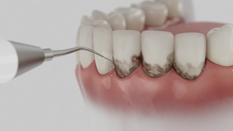 Trusted Tooth Extraction service in Franklin, OH - Dentist Open Now